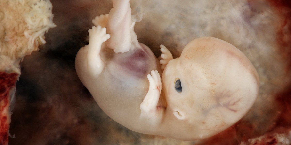 Image of human embryo 7-8 weeks from conception